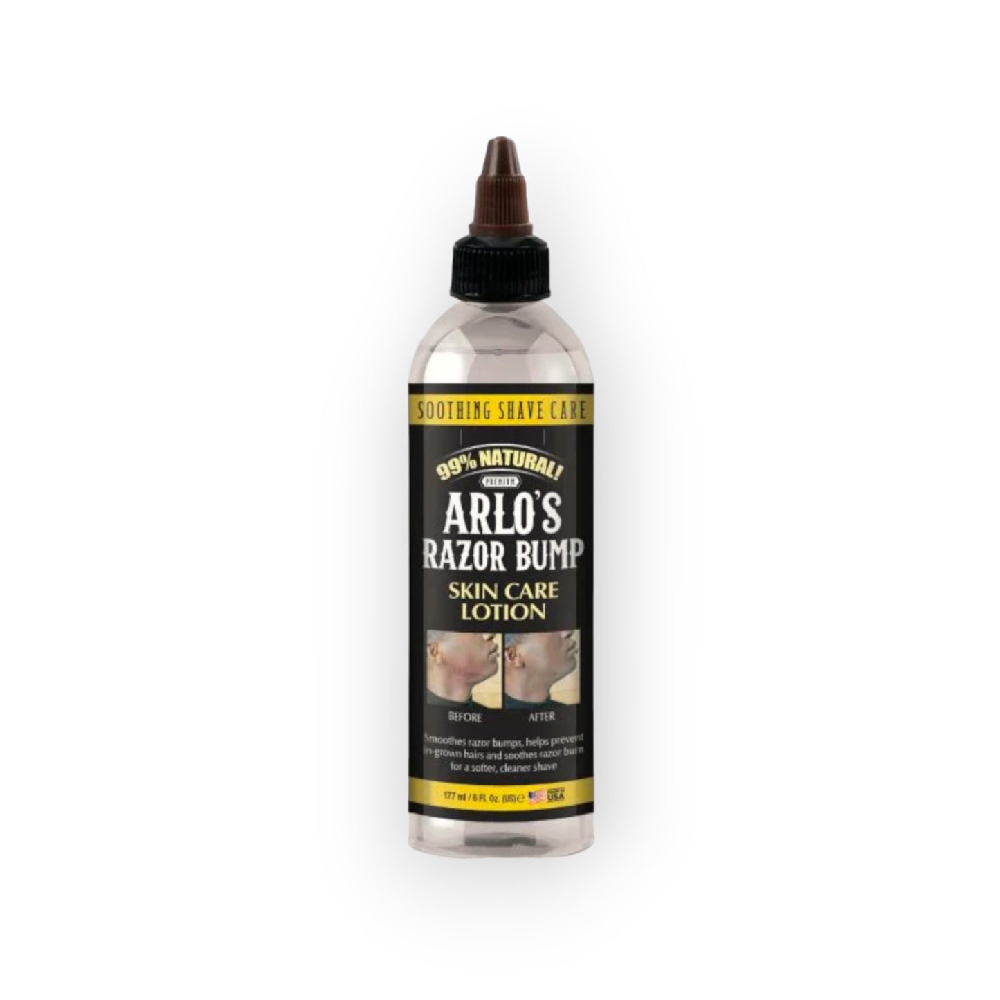 Arlo's Razor Bump Skin Care Lotion 177ml.