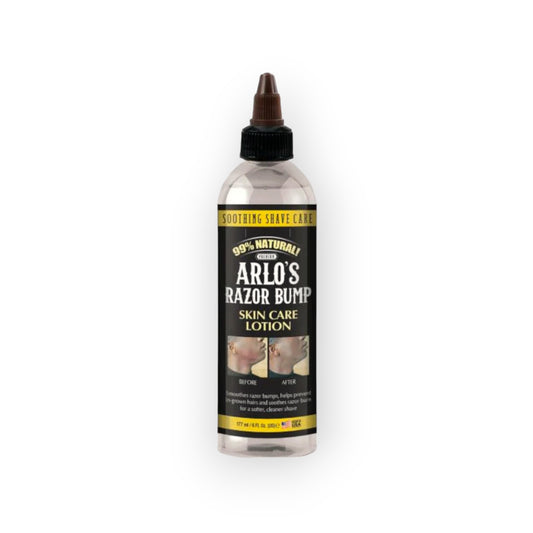 Arlo's Razor Bump Skin Care Lotion 177ml.